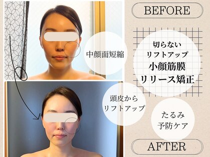 アイリス(IRIS)の写真