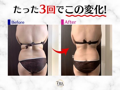トワ 大宮(TOWA)の写真
