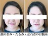 【むくみ・二重あご・たるみ改善】小顔矯正お試し40分