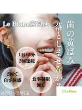 ルブラン 奈良店(Le Blanc)/黄ばみ大丈夫ですか？