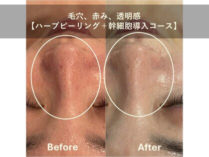 ヴィベル(vi Belle)の写真