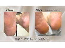 ハナンネイル(HANAN nail)