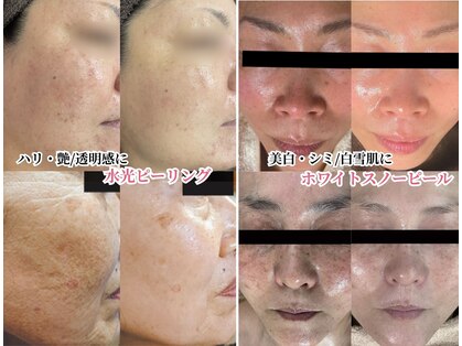 ミレット(Miretto)の写真