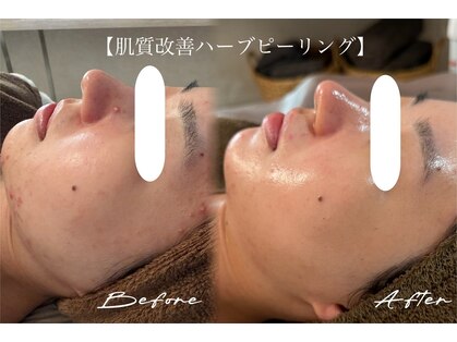 アピュルテ(A purete')の写真