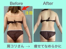 ビーナイス ビューティー(Be Nice Beauty)/◆凝り固まった筋肉のハリ解消◆