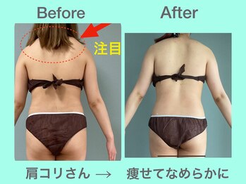 ビーナイス ビューティー(Be Nice Beauty)/◆凝り固まった筋肉のハリ解消◆