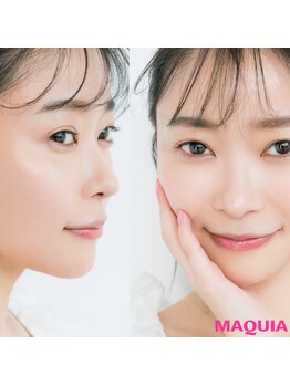 オプレア 千種店(OPREA)/指原莉乃さんもコルギおすすめ！