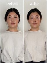 美容整体プラスキュー五反田/小顔・面長