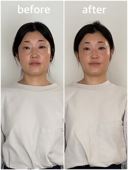美容整体プラスキュー五反田/小顔・面長