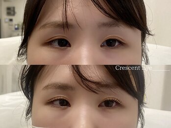 クレセントアイ 浜松店(Crescent Eye)/パリジェンヌラッシュリフト