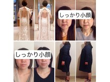 姿勢も小顔もお任せください。何歳からでもきれいになれます。