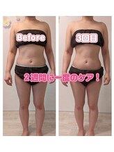 ムーンブロッサム(MoonBlossom)/上半身or下半身オールハンド90分