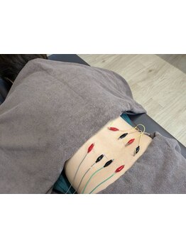 鍼灸施術を受けたい