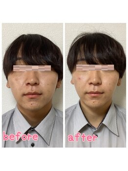 小顔整体 優/むくみもスッキリ☆