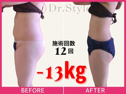 痩身エステ 美容整体 ドクタースタイル(Dr.Style)の写真