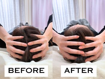 ビハリスト 麻布十番/頭のサイズからしっかり小顔に♪