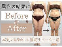 エクレ(eclat)