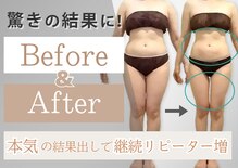 エクレ(eclat)