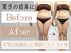 エクレ(eclat)の写真