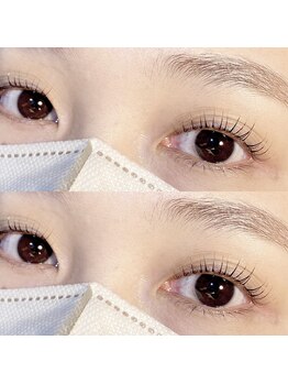 アトモス サニーテラス(Atmos sunny terrace)/ラッシュリフト　マツぱ