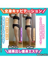 ビューティ ウィッチ(Beauty Witch)/