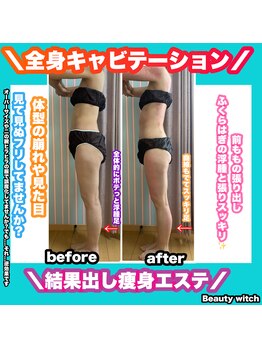 ビューティ ウィッチ(Beauty Witch)/