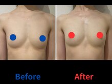 ポインセチア(Poinsettia)/ダイナミックバスト4DX/並び比較