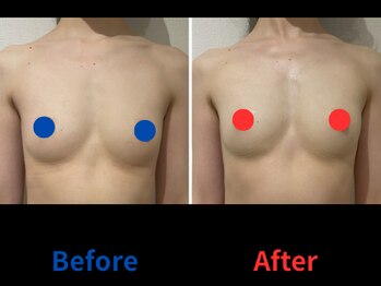 ポインセチア(Poinsettia)/ダイナミックバスト4DX/並び比較