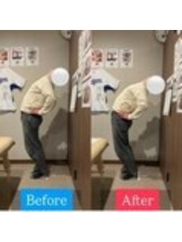 ナオル整体 宮崎院(NAORU整体)/30代男性施術事例【腰伸展制限】