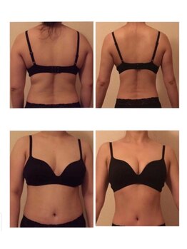 韓国式肌質改善・バストケアサロンKaela【4月 NEW OPEN(予定)】/30代/出産経験あり