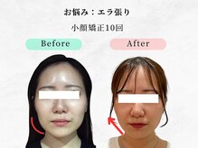 美容整体ウェリナ 中川八田院/小顔矯正/骨盤矯正/痩身整体