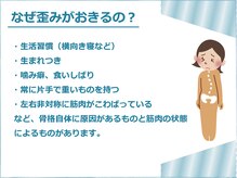 エスク(ESQUE)/なぜ歪みがおきるの？