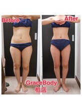 痩身 脱毛専門店 グレイスボディ 柏本店(Grace Body)/痩身　症例写真１