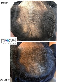 ヒルナム(Heal Nam)/プロセルセラピーズ~頭皮~