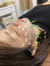 横浜青葉台鍼灸マッサージ院/