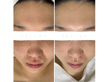 プラセル(Placer)/コツコツしか勝たん!!