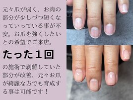 パラジェル深爪緩和クリアコース