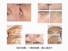 まぁ ま 西葛西店/若見え ☆ 1回でも違った印象に