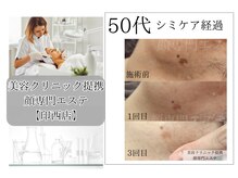 顔専門エステ 印西店