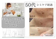 顔専門エステ 印西店