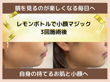 フェリス(feliz)の写真
