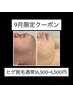 《9月男性限定》大人気ヒゲ脱毛初回1500円