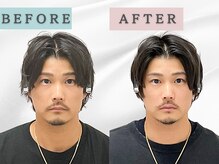 エルシンメトリー矯正院(ailesシンメトリー矯正院)/before＆after　ailes式小顔矯正