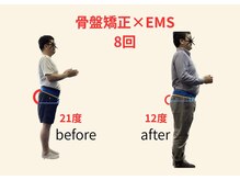 リボーン(REBORN)/整体/骨盤矯正/EMS