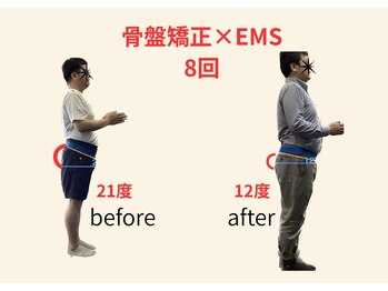 リボーン(REBORN)/整体/骨盤矯正/EMS