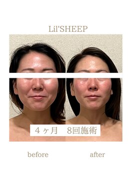 リルシープ(LIL'SHEEP)/