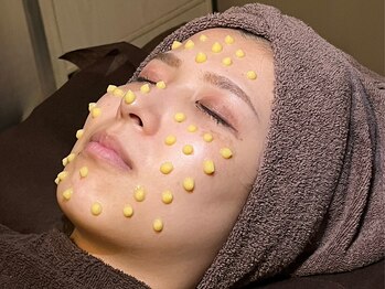 オアシス 船橋店(Oasis)の写真/【ニキビケア・毛穴改善】最新ゴールドピーリングで肌サイクルを整え、滑らかで毛穴レスなつるつる美肌に♪