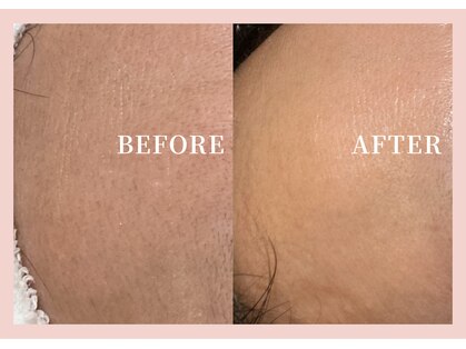 ハナハナ(hanahana)の写真