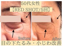 エトワール(etoile)/目の下たるみ.小じわ改善|天王寺