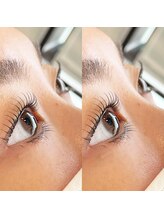 アイラッシュ ティル(eyelash till)/ラッシュリフト